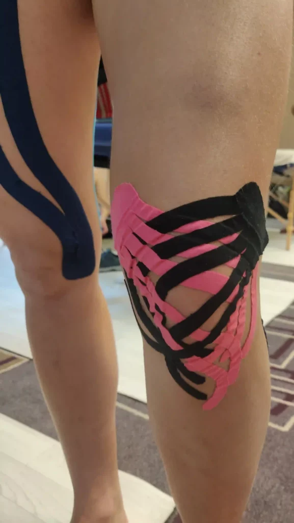 Pose De Bandes De Taping Decompressif Decontracturant Dardilly Metmassages