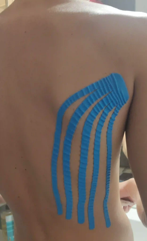 Pose De Bandes De Taping Decompressif Douleurs Musculo Articulaires Metmassages