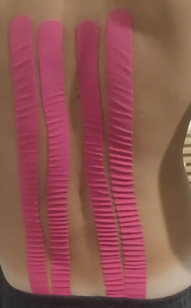 Pose De Bandes De Taping Decompressif Metmassages
